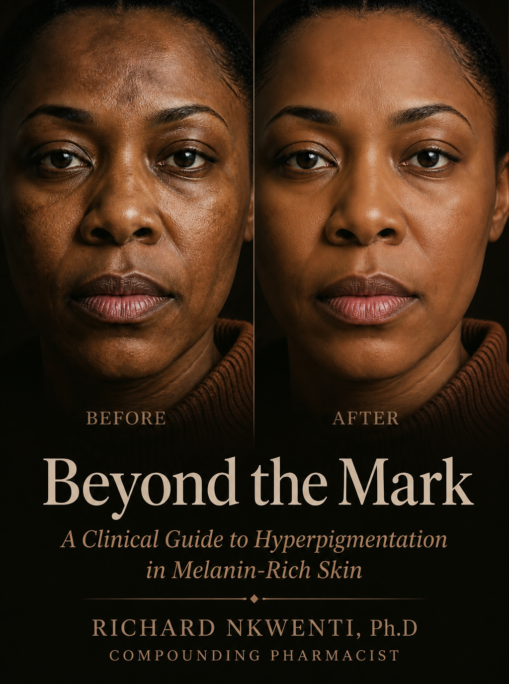 Beyond the Mark: A Clinical Guide to Hyperpigmentation in Melanin-Rich Skin